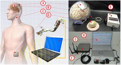 A Fully Implantable Wireless ECoG 128-Channel Recording Device for Human Brain–Machine Interfaces: W-HERBS